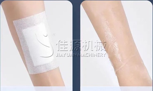 Application of Hot Melt Adhesive in Medical Products
